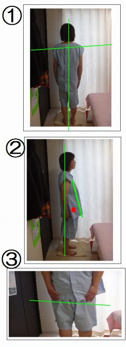 ���ŕ����Ǔ����_�c�͂�܂����̊��҂̐�