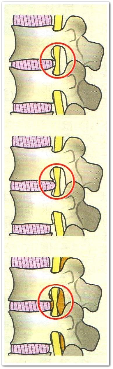 ����Ǎ���ŊԔ�x�т̕ό`����Ȃ�ɂݐ_�c���̉@�͂�܂���