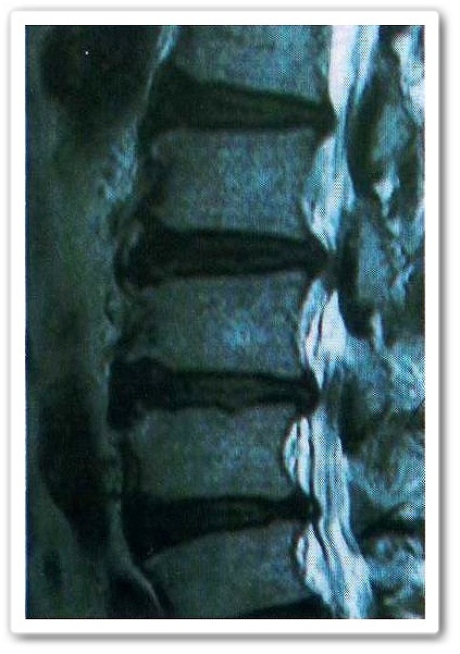 �Ғ��ǋ���ǃ����g�Q���ʐ^�̉摜�_�c�͂�܂������̉@